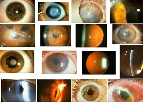 Image result for Iris Recognition Using MATLAB Source Code