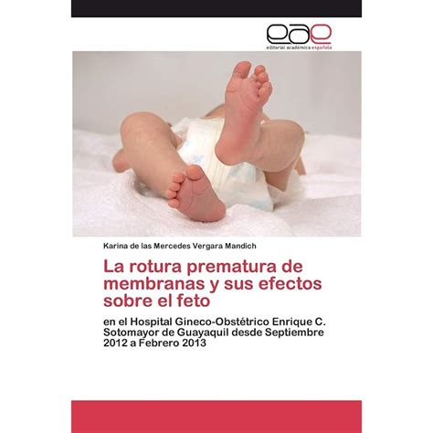 Buy La rotura prematura de membranas y sus efectos sobre el feto Online ...