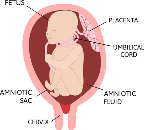 Umbilical Cord Around Neck During Pregnancy Always Means Brain Injury ...