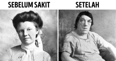 Wanita Ini Rela Dijuluki sebagai “Wanita Paling Jelek” agar Anak ...