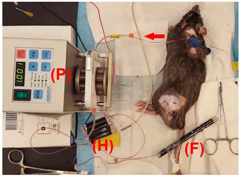 Extracorporeal Removal of Thermosensitive Liposomal Doxorubicin from ...