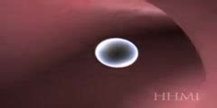 Image result for Human Reproduction Animation
