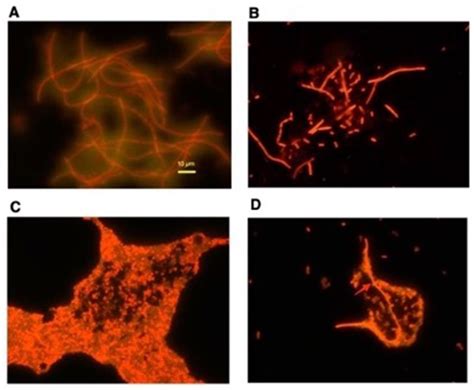 Psychoactive Drugs Induce the SOS Response and Shiga Toxin Production ...