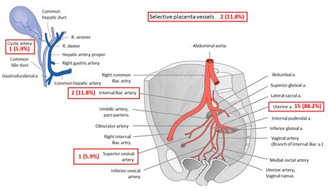 Management and Outcome of Women with Placenta Accreta Spectrum and ...