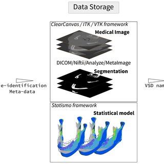 Image result for A Coding VSD Coding
