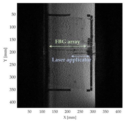 Sensors | Special Issue : Sensors for Biomedical Imaging