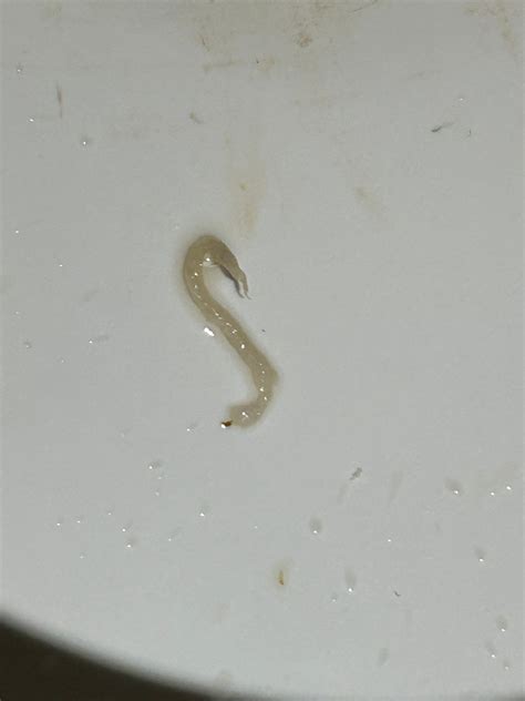 What is this? | BabyCenter