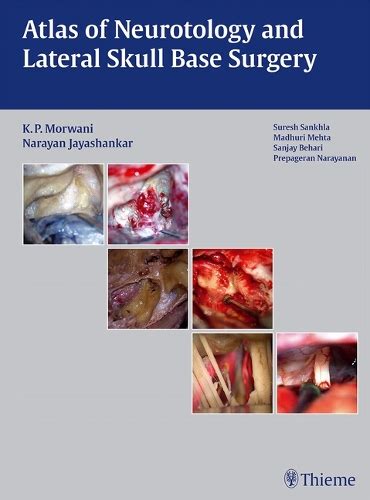 Buy Atlas of Neurotology and Lateral Skull Base Surgery