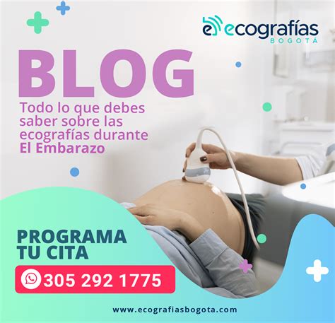 Todo lo que debes saber sobre las ecografías durante el embarazo - Ecografías Bogotá
