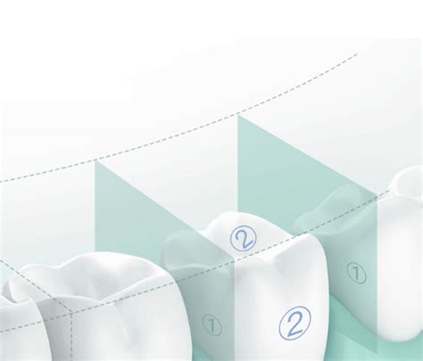 Buy Cordless Waterpik Water Flosser Dental Oral Irrigator Travel Teeth ...