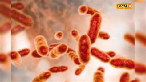 Brucellosis Symptoms: బ్రూసెల్లోసిస్ వ్యాధి లక్షణాలు ఇవే.. మనుషులకు ...