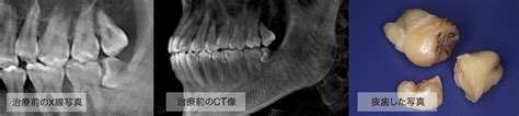 Image result for Python Stem to Vector