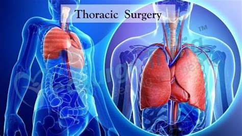 Best Cardiothoracic Surgery In Kurnool | Gowri Gopal Hospital