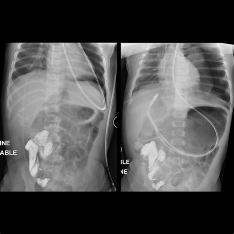 April 2, 2020 - Pediatric Imaging