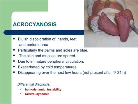 Common neonatal problems | PPT