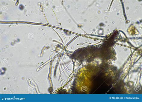 Fungal Hyphae Under the Microscope Stock Image - Image of cell ...