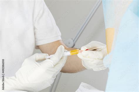 Injection Back Side 的图像结果