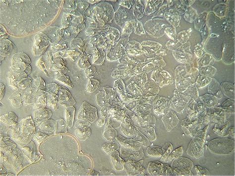 Phase Contrast Microscope | Microbus Microscope Educational Website