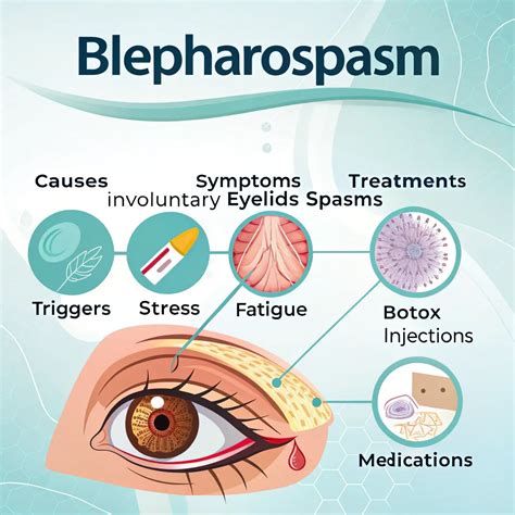 Blepharospasm: Understanding the Causes, Symptoms, and Treatments for Involuntary Eyelid Spasms ...