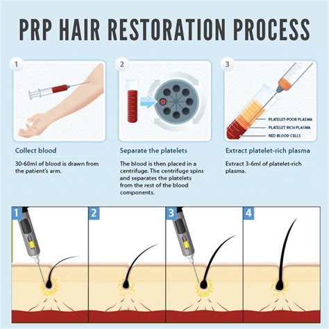 Prp Hair Restoration