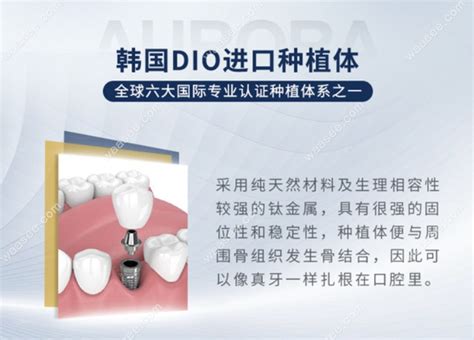 韩国十大种植牙品牌排行榜，看韩国种植牙哪个牌子的好 - 口腔资讯 - 牙齿矫正网