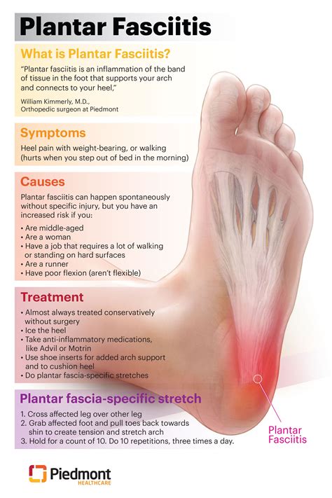 What is plantar fasciitis – Artofit
