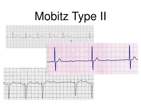Image result for ACLS Code Blue Algorithm