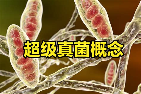 黄广华课题组在“超级真菌”致病性研究方面取得重要进展