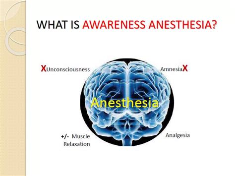 Anesthesia Awareness 的图像结果