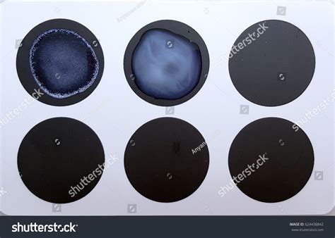 Image result for Agglutination Test