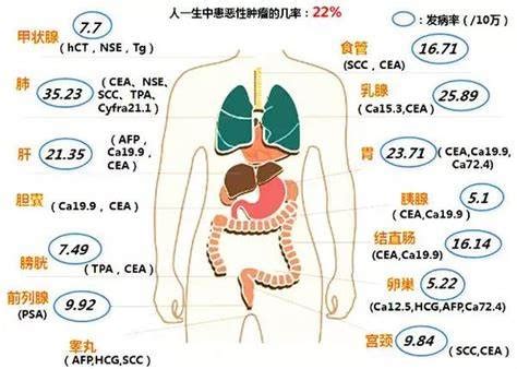 肿瘤标志物科普系列--CA724升高原因分析 - 知乎