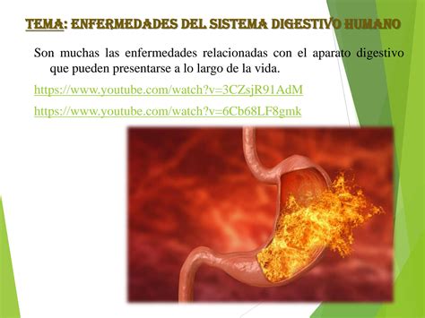 SOLUTION: Enfermedades del sistema digestivo - Studypool