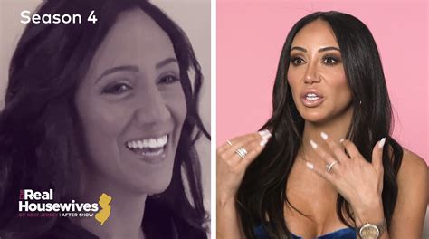 Melissa Gorga claims Teresa Giudice got her forehead lengthened