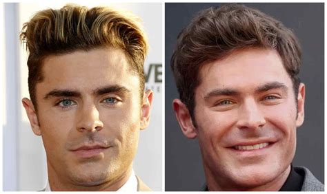 Zac Efron Face Plastic Surgery Video