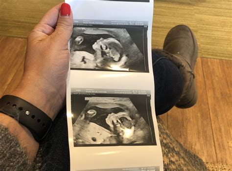 Tell Your Story and Find Support | Fertility Centers of Illinois