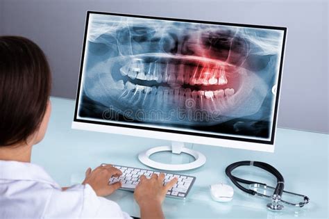Image result for Teeth Computer