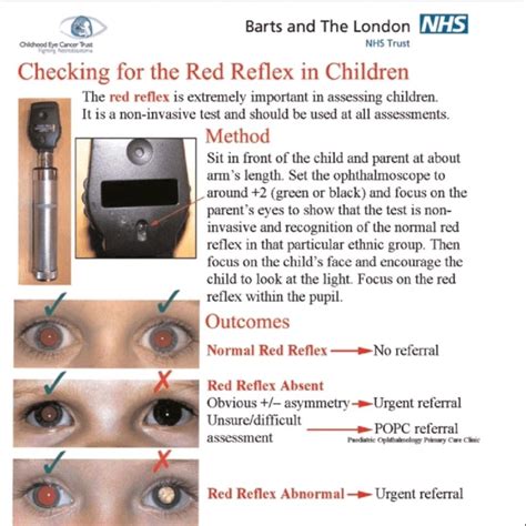 Dr.Mazen Mahmoud on LinkedIn: Red reflex in pediatrics