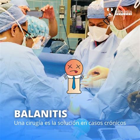 Hasta cuando debo tratar mi balanitis? – Urología Peruana. Dr. Susaníbar