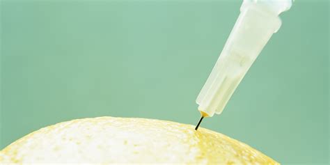 Cortisone Injections Into Acne Nodules Cysts at Herman Stgermain blog