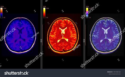 High Res Brain Scan Image 的图像结果