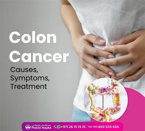 Colon Cancer Symptoms In Women
