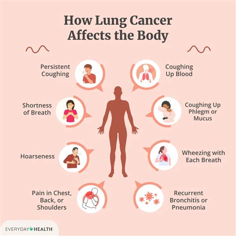 Symptoms Of Lung Cancer