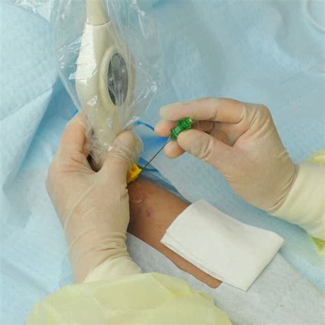 Surgery 的图像结果