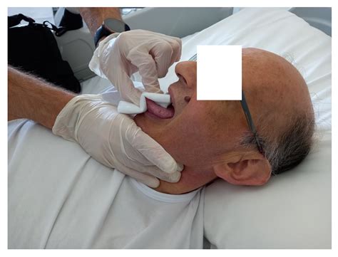 Hyoid Bone Syndrome in a Patient Undergoing Left Ventricular Assist ...