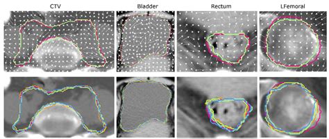 Comparative Analysis of Repeatability in CT Radiomics and Dosiomics ...
