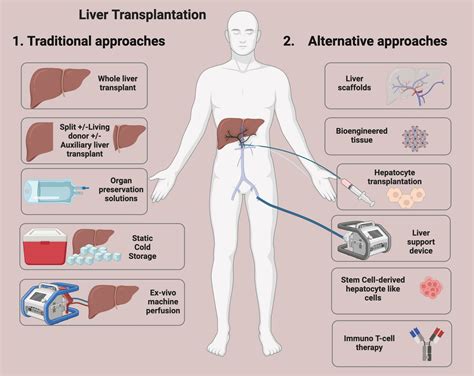 New Developments and Challenges in Liver Transplantation