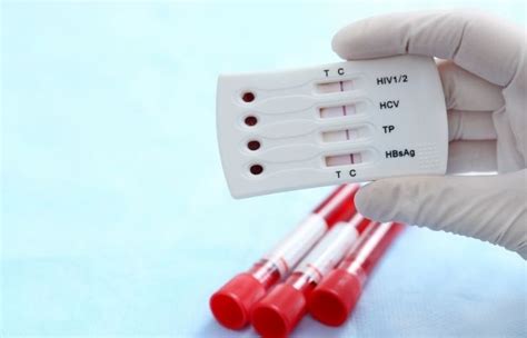 Self-Care Is Getting Checked – Your Honest Guide To STD Testing Frequency