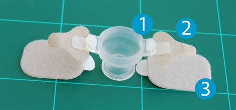 Stimmprothese » Tracheostomabutton