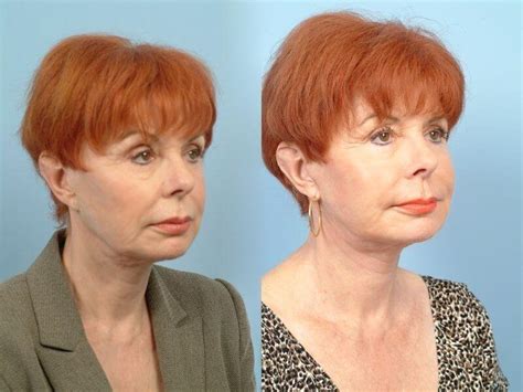 Image result for Cheek Threading