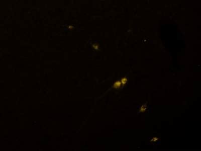 Fluorescent Neuronal Cells - Dataset Ninja